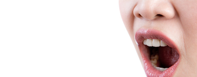 Ouvrière avec une mauvaise haleine…